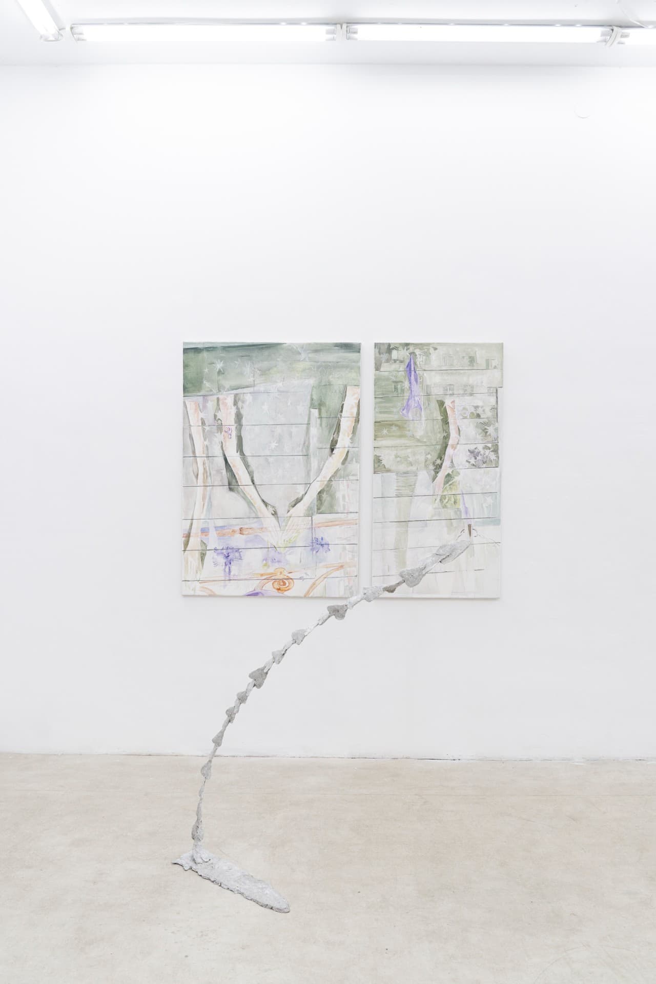 The Shape of a Scar installation view 7