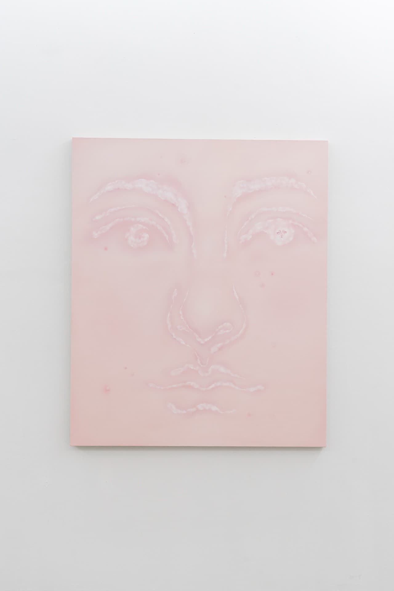 The Shape of a Scar installation view 14