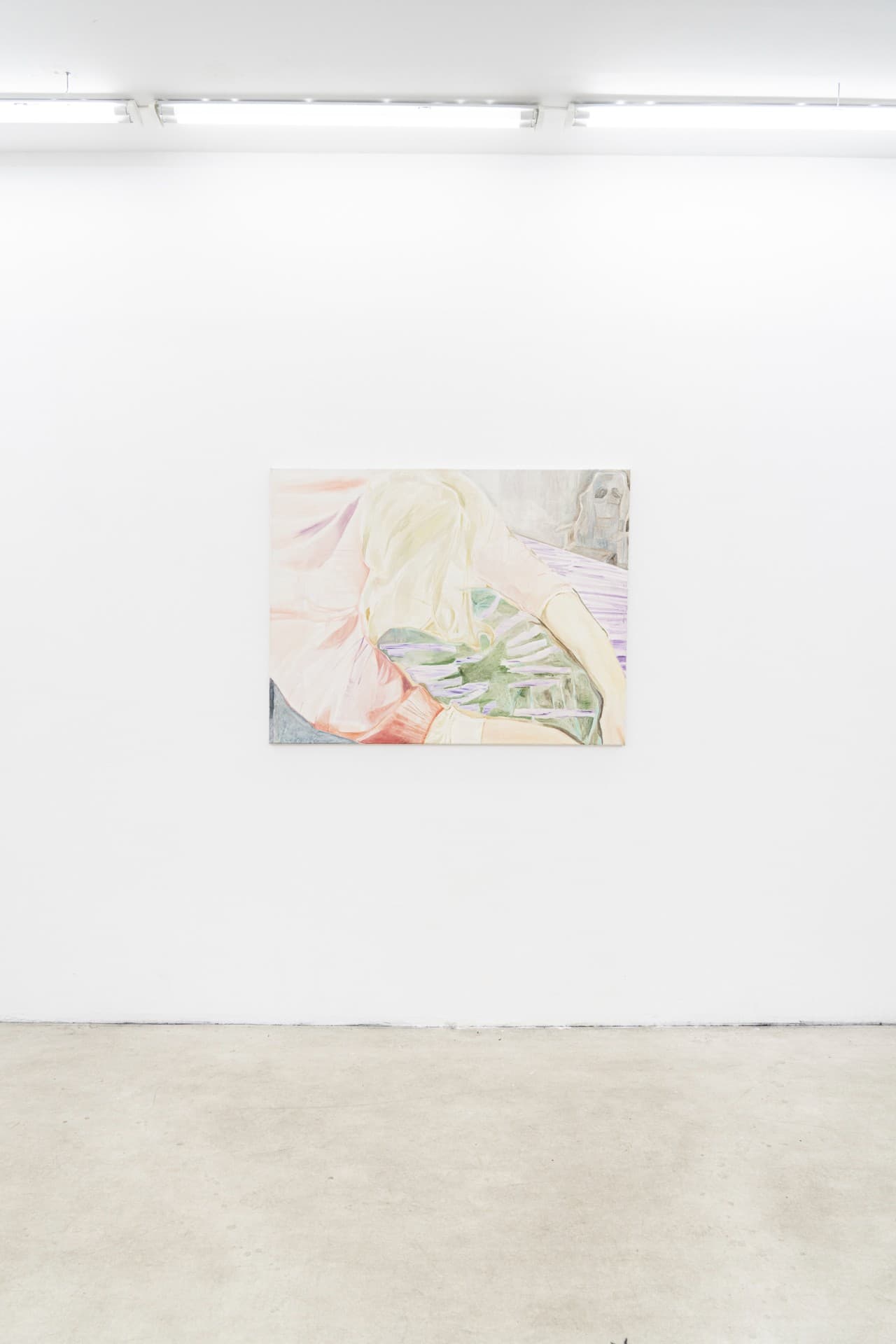 The Shape of a Scar installation view 20